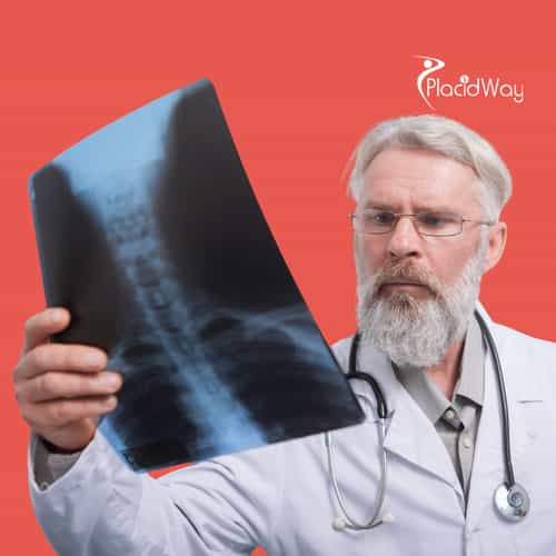 Bone Cancer Treatment Insights for Patients Considering Mexico